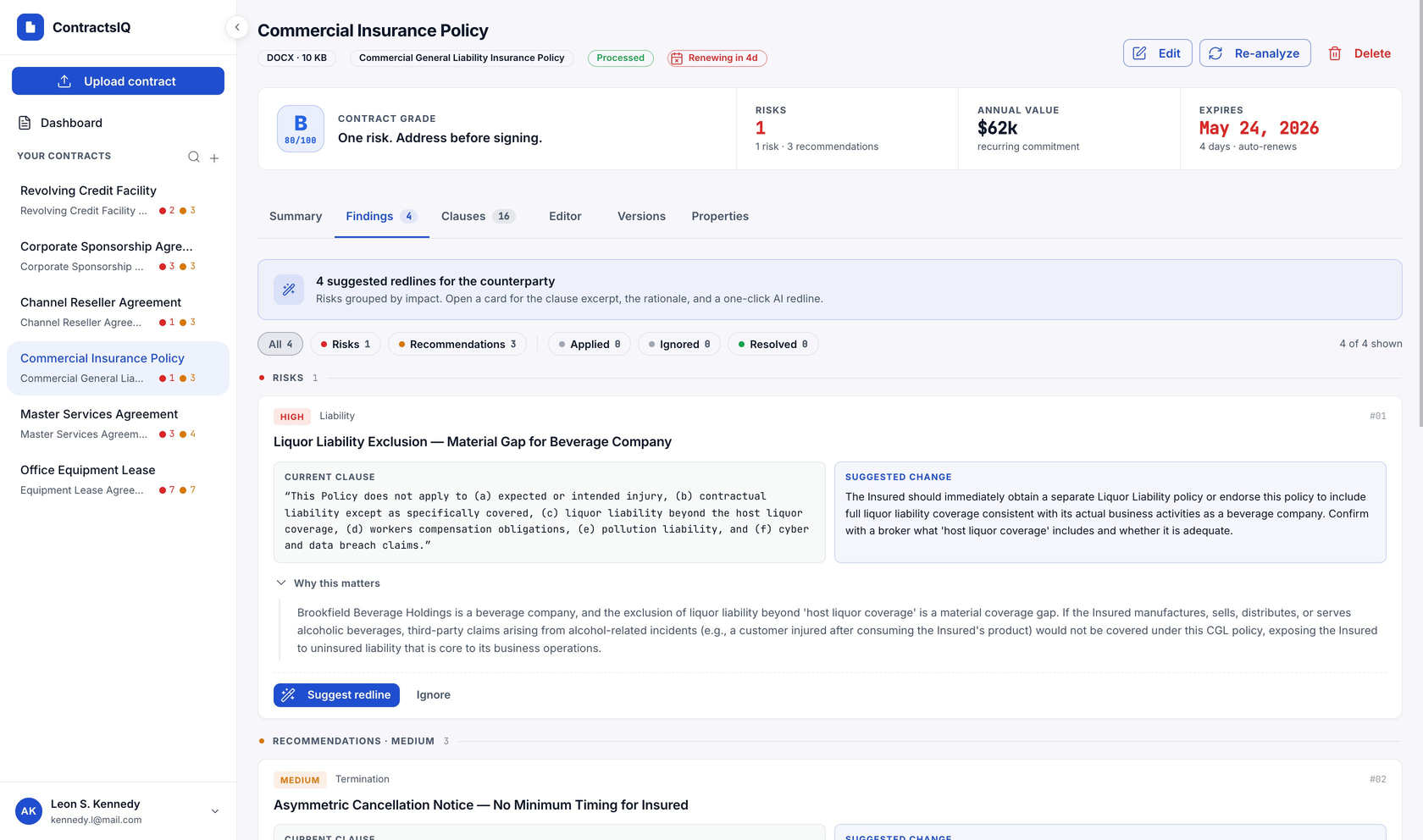 ContractsIQ findings view in light theme